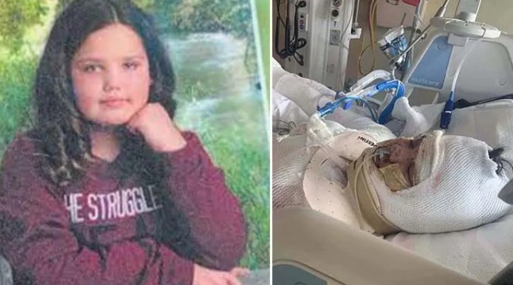 Tiktok faciası! 13 yaşındaki kız feci şekilde yaralandı!