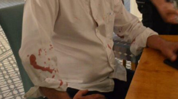 CHP'li belediye başkanına beyzbol sopalı saldırı