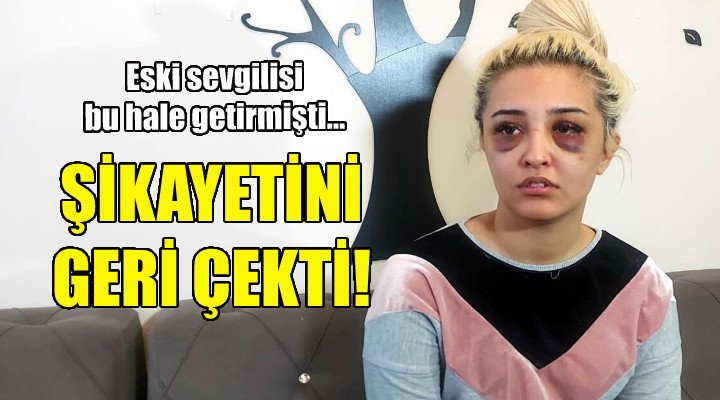 Eski sevgilisi bu hale getirmişti... Şikayetini geri çekti!