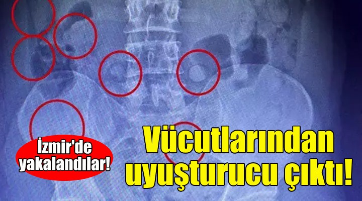 İzmir'de yakalandılar... Vücutlarından uyuşturucu çıktı!