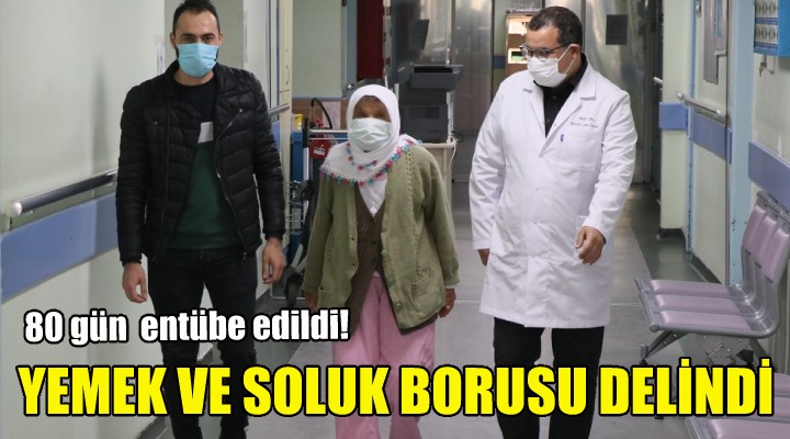 Koronavirüs yüzünden yemek ve soluk borusu delindi!