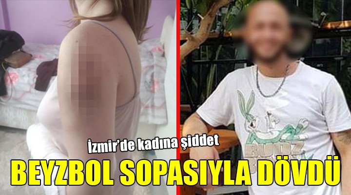 Sevgilisini beyzbol sopasıyla dövdü